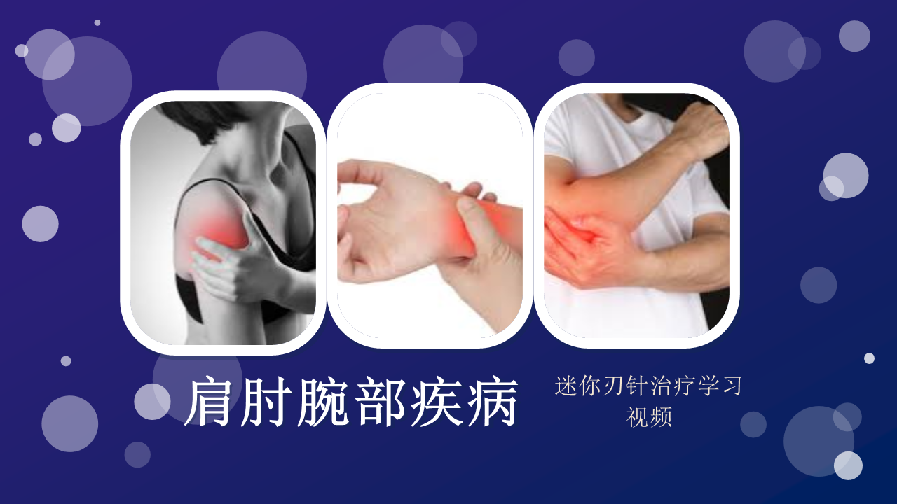 MRA Case Study for Shoulder Elbow Wrist Hand Disease